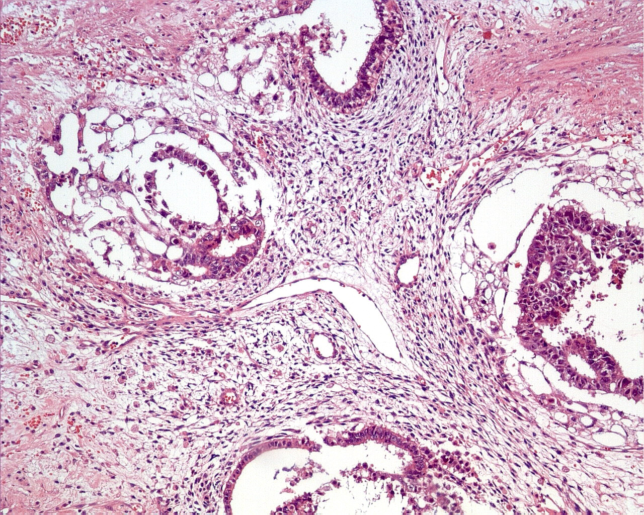 c16