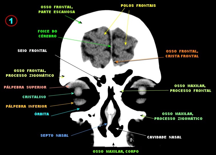 Bronstein - RM, Já imaginou um exame que pode detalhar todos os tecidos do  corpo em imagem, detectar cânceres, mapear a atividade cerebral e, ao  contrário do raio-X, não